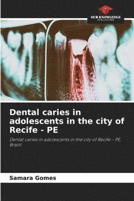 Dental caries in adolescents in the city of Recife - PE 1