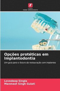 bokomslag Opções protéticas em Implantodontia