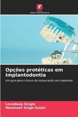 bokomslag Opes protticas em Implantodontia