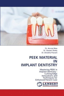 bokomslag Peek Material in Implant Dentistry