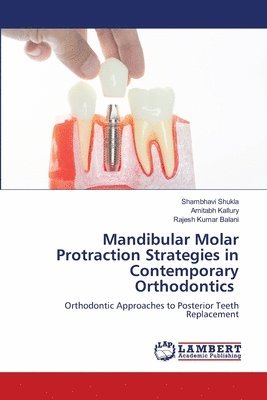 bokomslag Mandibular Molar Protraction Strategies in Contemporary Orthodontics