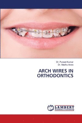 bokomslag Arch Wires in Orthodontics