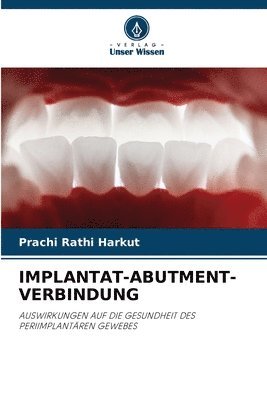 bokomslag Implantat-Abutment-Verbindung