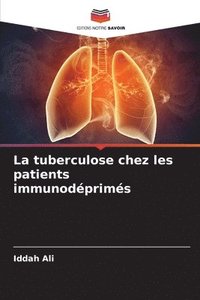 bokomslag La tuberculose chez les patients immunodprims