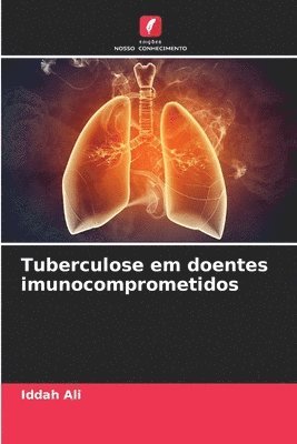 bokomslag Tuberculose em doentes imunocomprometidos