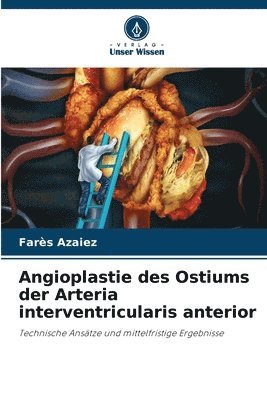 bokomslag Angioplastie des Ostiums der Arteria interventricularis anterior