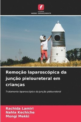 Remoção laparoscópica da junção pieloureteral em crianças 1