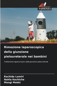 bokomslag Rimozione laparoscopica della giunzione pieloureterale nei bambini