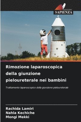 Rimozione laparoscopica della giunzione pieloureterale nei bambini 1