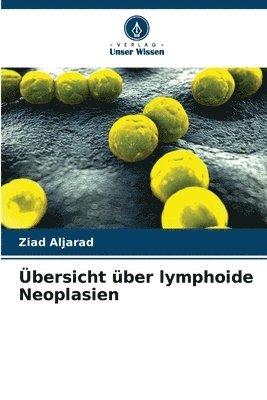 bokomslag Übersicht über lymphoide Neoplasien