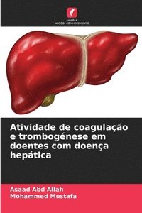 bokomslag Atividade de coagulação e trombogénese em doentes com doença hepática