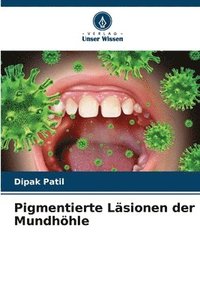 bokomslag Pigmentierte Läsionen der Mundhöhle