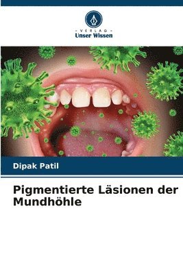 Pigmentierte Läsionen der Mundhöhle 1