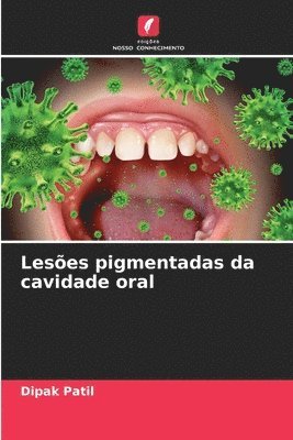 Lesões pigmentadas da cavidade oral 1