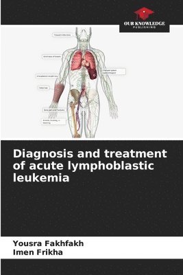 bokomslag Diagnosis and treatment of acute lymphoblastic leukemia