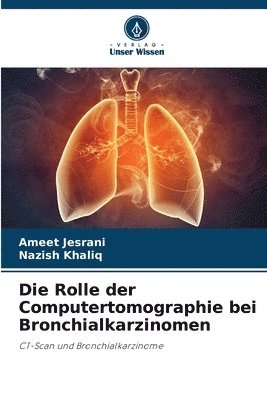 Ameet Jesrani, Nazish Khaliq - Rolle der Computertomographie bei Bronchialkarzinomen, Häftad