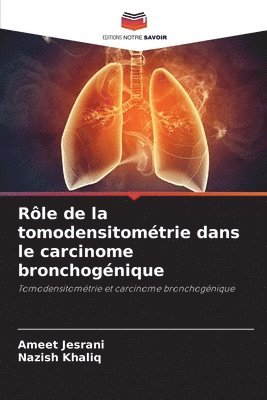 Ameet Jesrani, Nazish Khaliq - Rôle de la tomodensitométrie dans le carcinome bronchogénique, Häftad