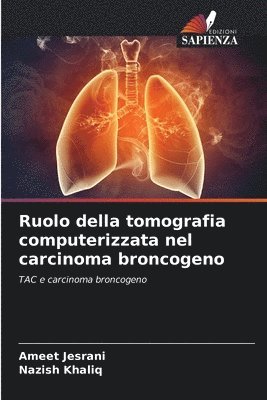 bokomslag Ruolo della tomografia computerizzata nel carcinoma broncogeno