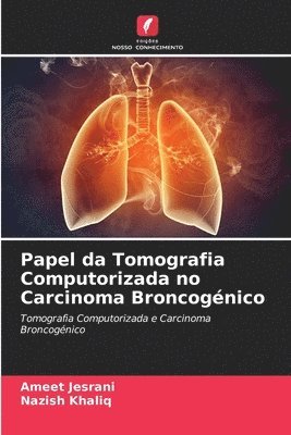 Papel da Tomografia Computorizada no Carcinoma Broncognico 1