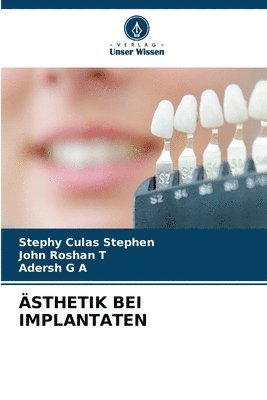 bokomslag sthetik Bei Implantaten