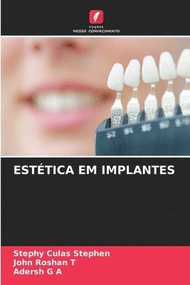 Stephy Culas Stephen, John Roshan T, Adersh G a, John Roshan T., Adersh G A - Estética Em Implantes, Häftad