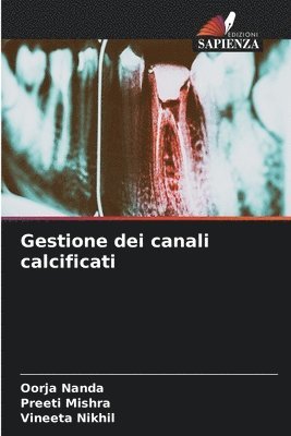 bokomslag Gestione dei canali calcificati