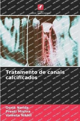 bokomslag Tratamento de canais calcificados