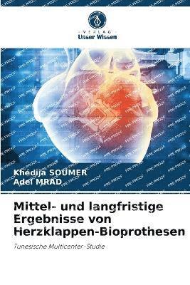 bokomslag Mittel- und langfristige Ergebnisse von Herzklappen-Bioprothesen