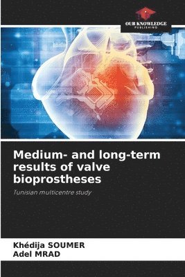 bokomslag Medium- and long-term results of valve bioprostheses