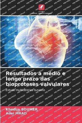 Resultados a médio e longo prazo das biopróteses valvulares
