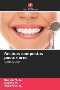 bokomslag Resinas compostas posteriores