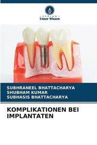 bokomslag Komplikationen Bei Implantaten