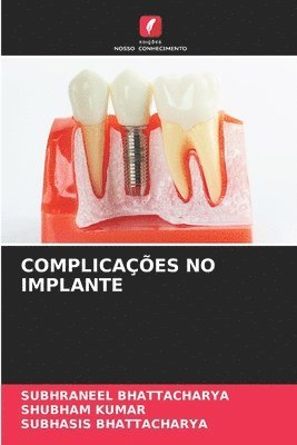 bokomslag Complicações No Implante