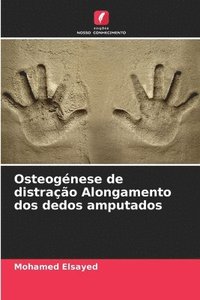 bokomslag Osteognese de distrao Alongamento dos dedos amputados