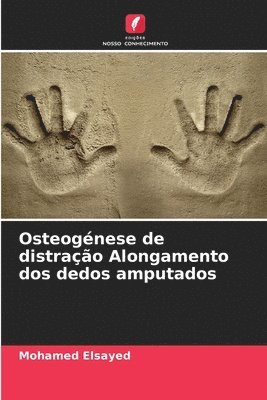 bokomslag Osteogénese de distração Alongamento dos dedos amputados