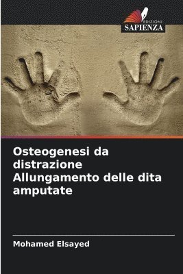 bokomslag Osteogenesi da distrazione Allungamento delle dita amputate