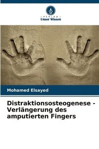 bokomslag Distraktionsosteogenese - Verlängerung des amputierten Fingers