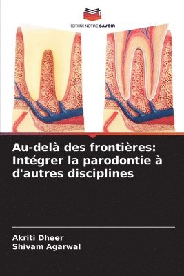 Au-delà des frontières: Intégrer la parodontie à d'autres disciplines 1