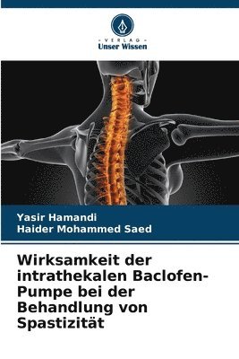Wirksamkeit der intrathekalen Baclofen-Pumpe bei der Behandlung von Spastizität