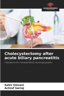 bokomslag Cholecystectomy after acute biliary pancreatitis