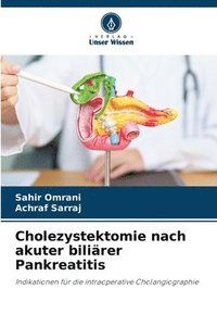 bokomslag Cholezystektomie nach akuter biliärer Pankreatitis