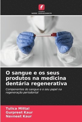 Tulica Mittal, Gurpreet Kaur, Navneet Kaur - O sangue e os seus produtos na medicina dentária regenerativa, Häftad