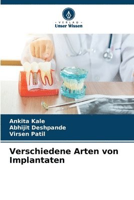 Verschiedene Arten von Implantaten 1