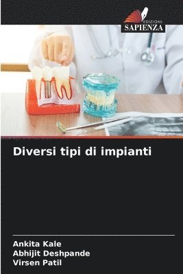 bokomslag Diversi tipi di impianti