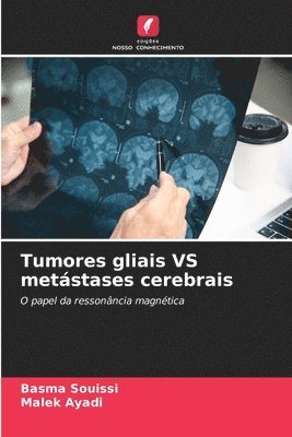 Basma Souissi, Malek Ayadi - Tumores gliais VS metástases cerebrais, Häftad