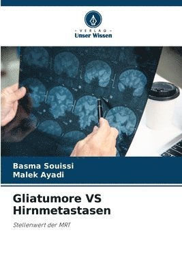 bokomslag Gliatumore VS Hirnmetastasen