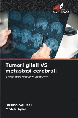 bokomslag Tumori gliali VS metastasi cerebrali