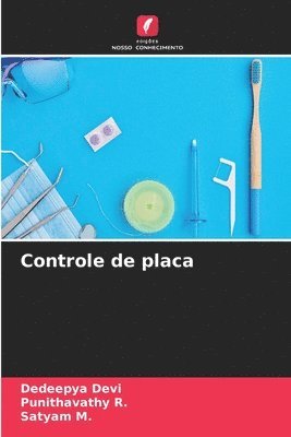 Controle de placa