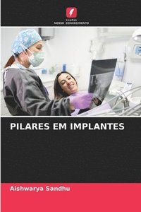 bokomslag Pilares Em Implantes