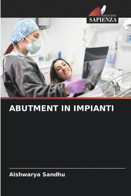 Abutment in Impianti